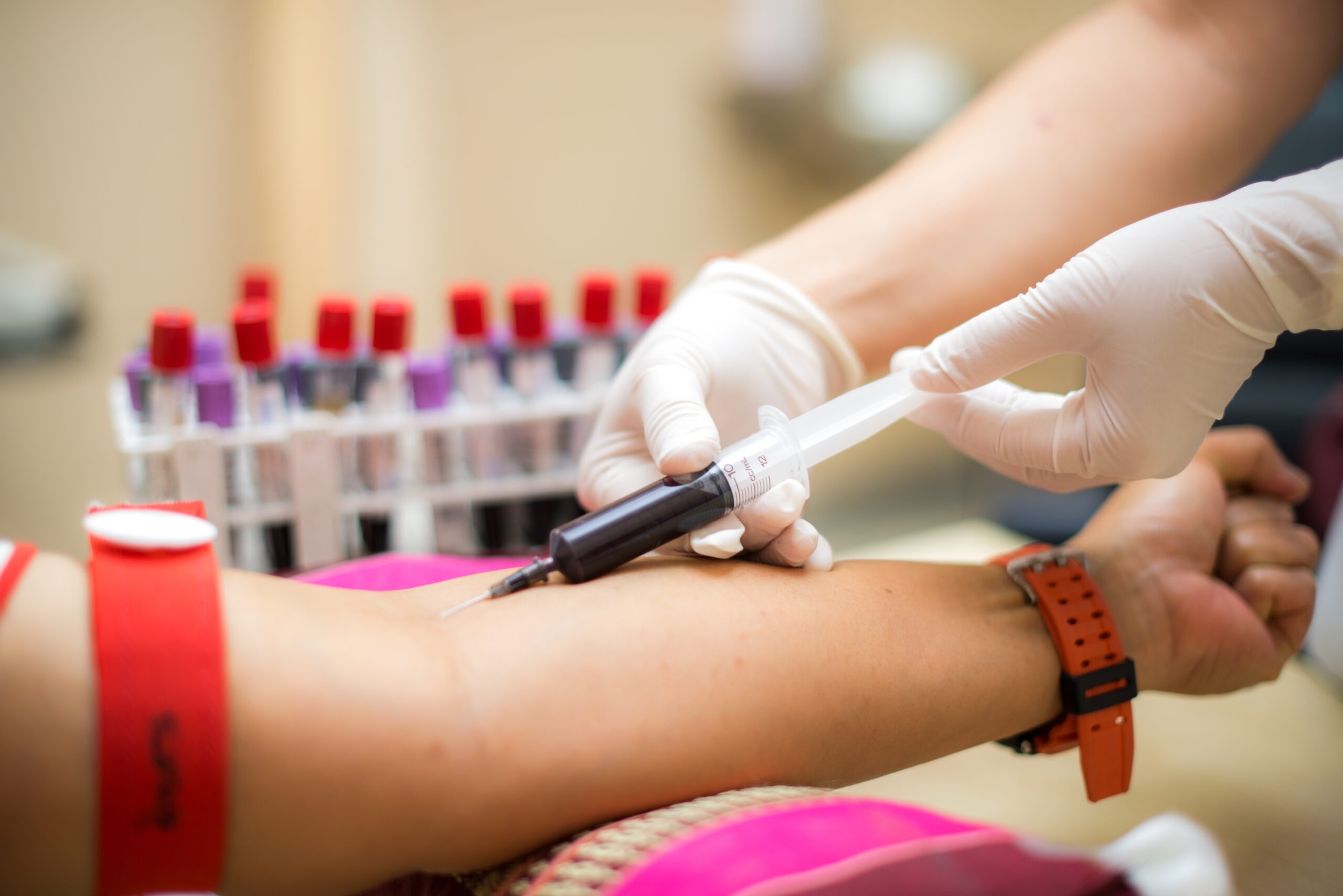 imgi_182_Blood-Tests-At-Home-Book-Blood-Test-Online-scaled