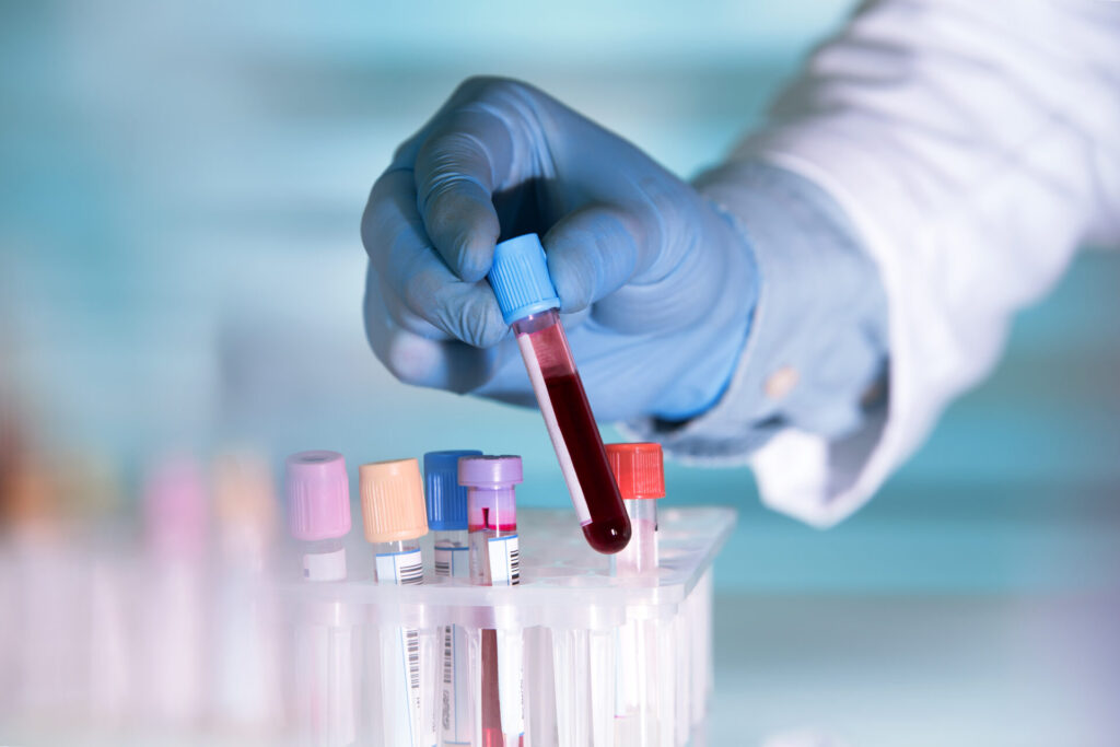 compare blood test prices without insurance