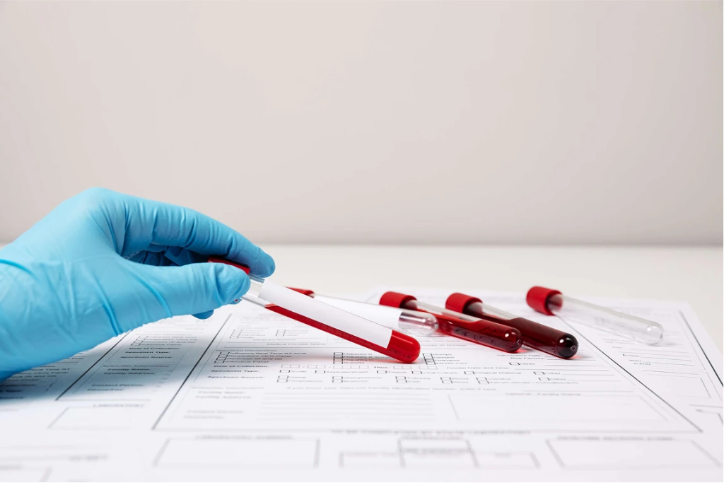 common myths about blood tests