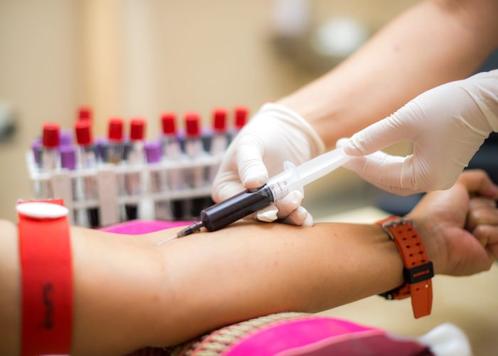 imgi_182_Blood-Tests-At-Home-Book-Blood-Test-Online-scaled